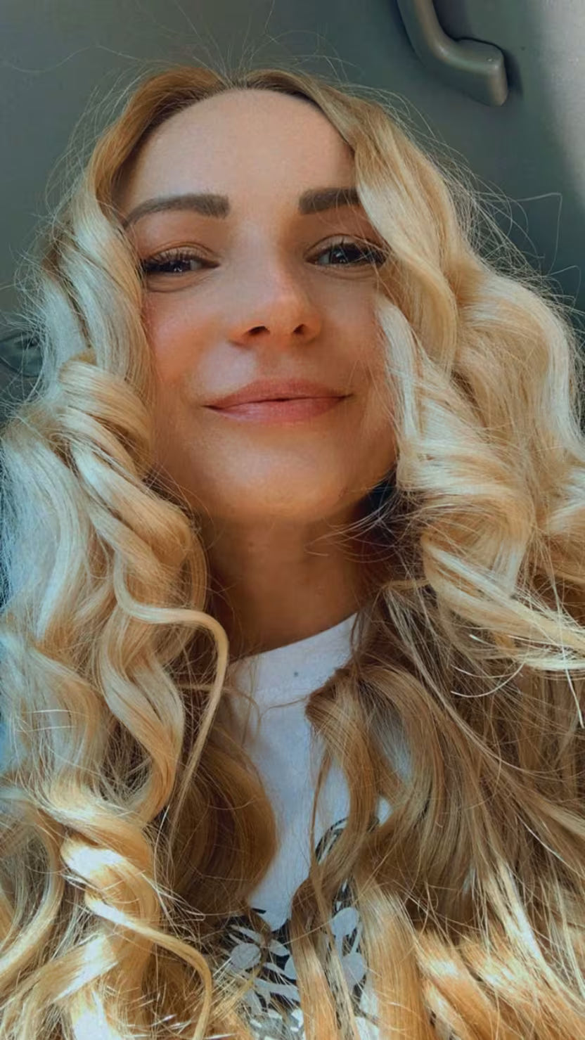 Happy woman with cleared acne after 6 months